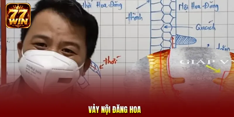 Vảy Nội Đăng Hoa